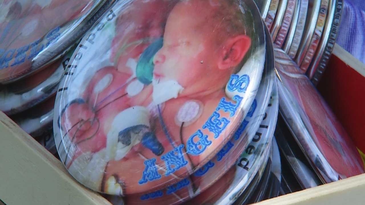 Macomb Woman Raises Money For Formerly Conjoined Twins