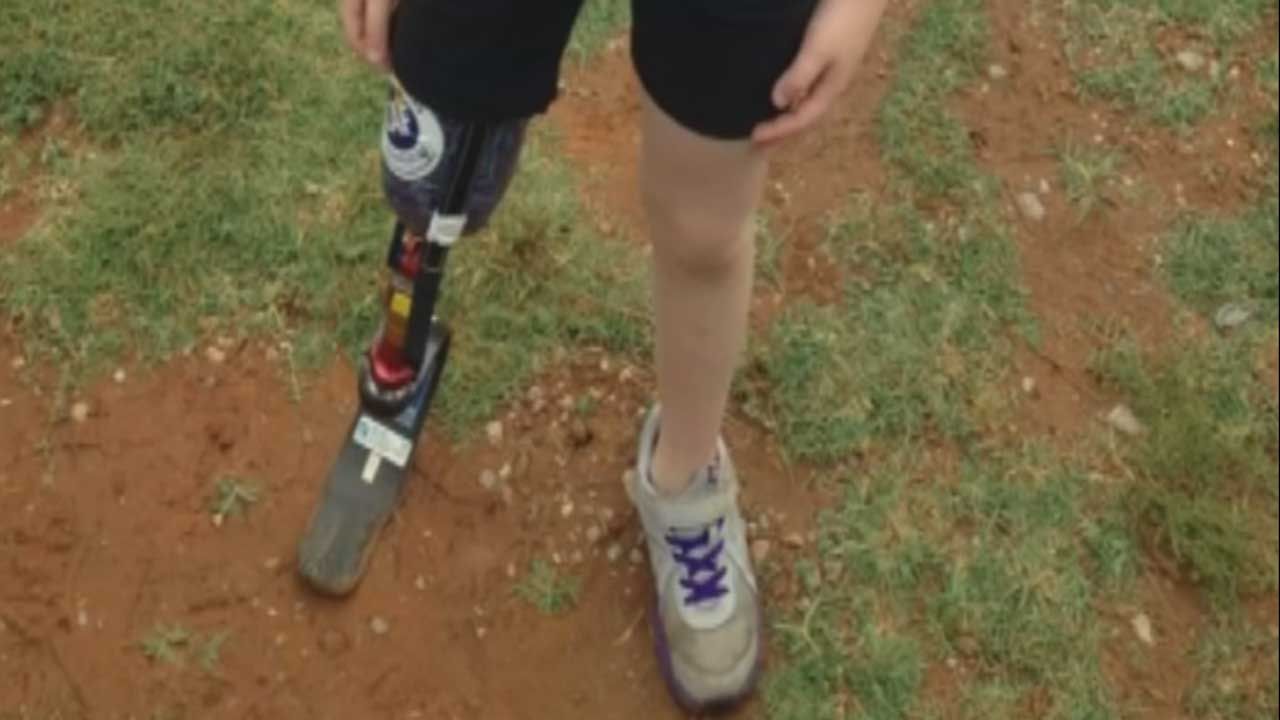 Bethel Acres Girl, 8, To Receive New Prosthetic For Running