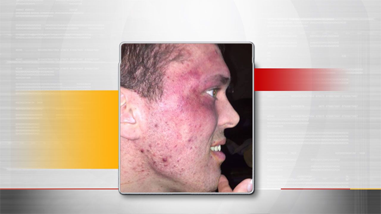 Mother Seeks To Press Charges For Alleged Caretaker Abuse At Stillwater Facility