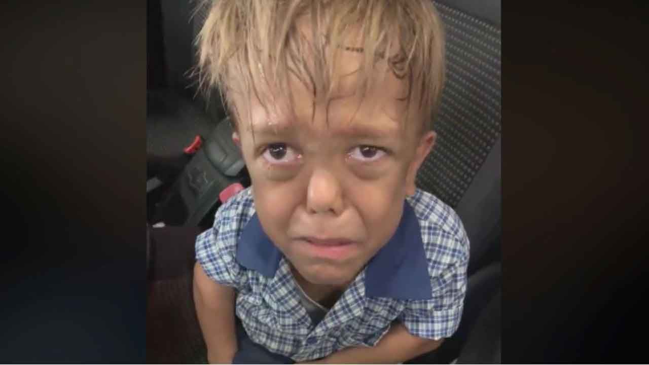 Mother Posts Heartbreaking Video Of Son With Dwarfism Sobbing A
